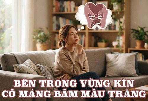 Bên trong vùng kín có mảng bám màu trắng và cách khắc phục